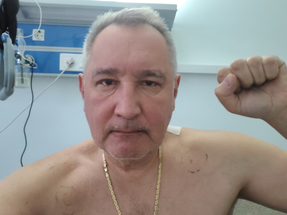 Рогозин показал, как выглядит после ранения и операции