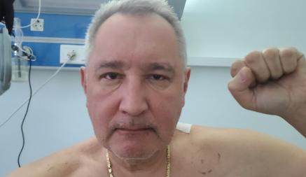 Рогозин показал, как выглядит после ранения и операции