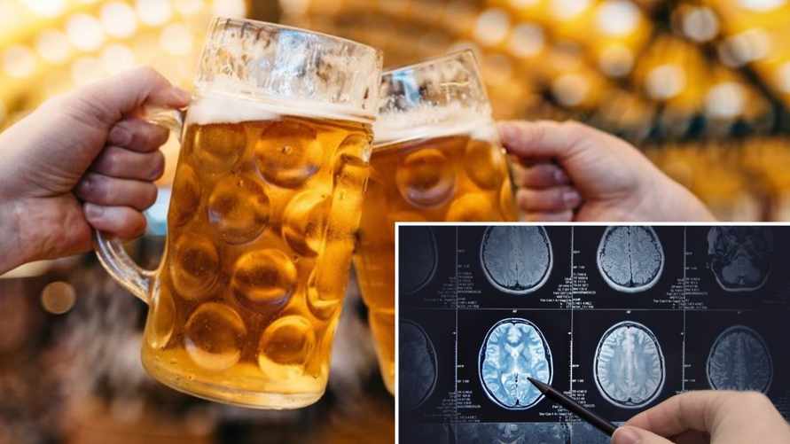 Ученые узнали, что будет с мозгом после отказа от алкоголя