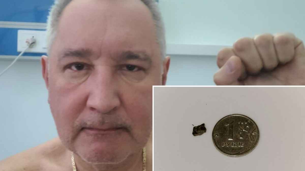 Раненый в ресторане Рогозин отправил Макрону осколок, который из него достали