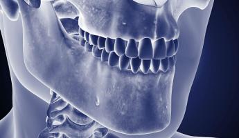 Белорусские стоматологи изобрели устройство для лечения храпа —  «Может смещать нижнюю челюсть»
