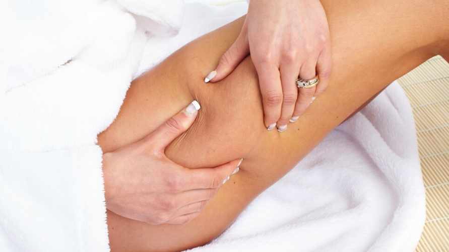 Как избавится от целлюлита перед летом? Эти белорусские народные средства действительно работают