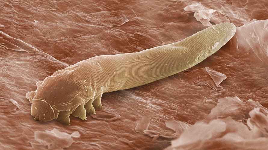 The harmless mite Demodex folliculorum, seen here in an electron microscope image, lives in the follicles of eyelashes
