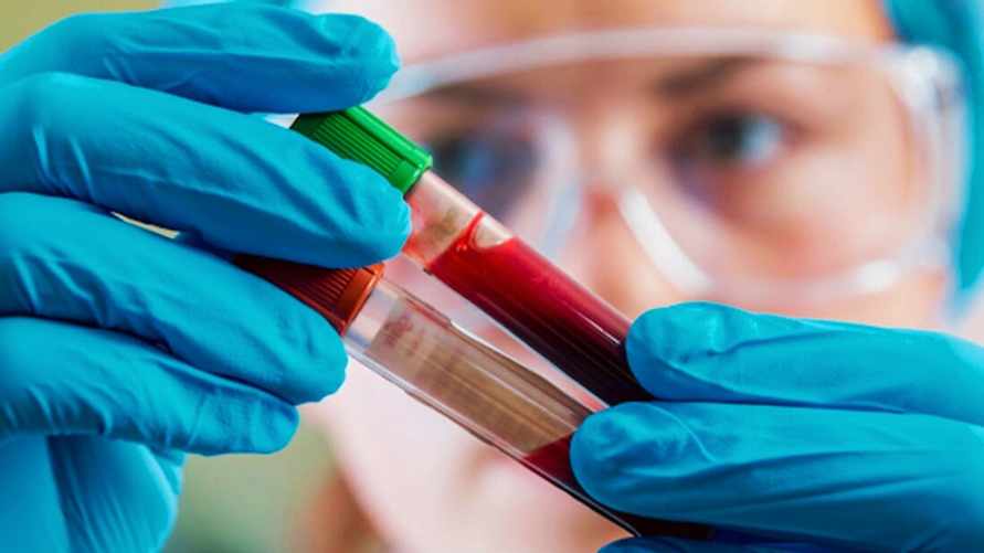 В Витебске назвали цену "доступного" теста на рак, который обещали белорусам