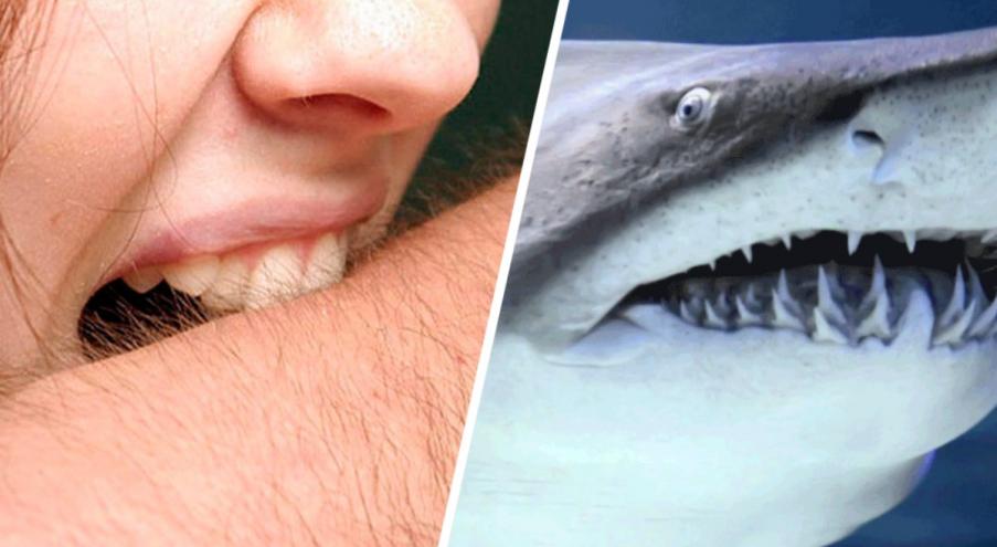 Жители Нью-Йорка кусают больше людей, чем акулы Многие