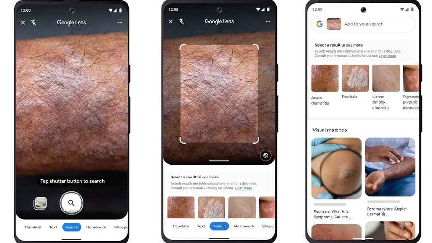 Google утверждает, что Lens может определить состояние кожи по фотографии