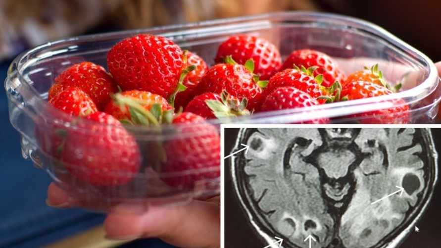 Почему белорусам нельзя есть немытую клубнику? Польский медик рассказал об ужасных последствиях