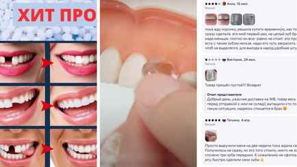 «Могу вытащить и заново поставить» — В Сети белорусам стали продавать… пломбы для зубов! Почем?