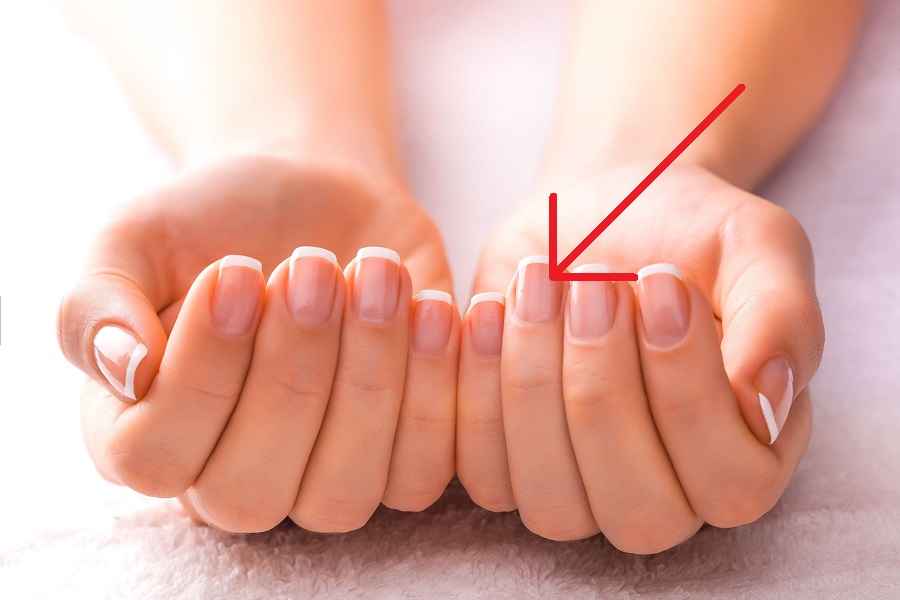 Фото иллюстрационное