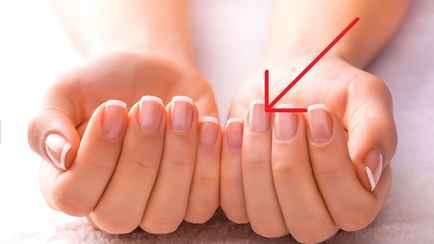 Эти следы на ногтях — признак «тихого убийцы». Проверьте, есть ли такие у вас