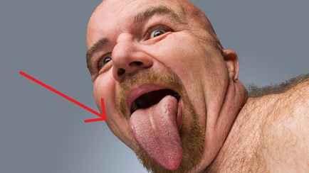 Как избавится от икоты за считанные секунды? Вам поможет… язык. Что с ним делать?