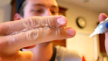 Как легко убрать клей с кожи? Просто протрите ее этими домашними средствами