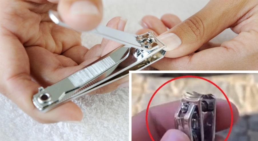 Многие применяют кусачки для обрезки ногтей вместе с