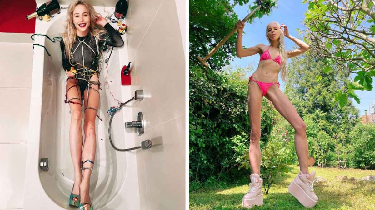 Девушка удлинила ноги на 14 см ради мужа. Но что-то пошло не так