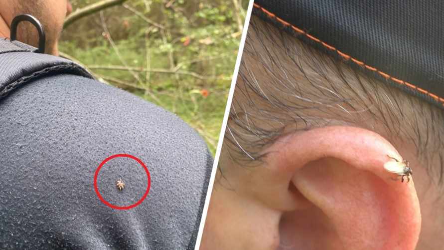 Белорусских грибников в лесах атаковали назойливые насекомые. Опасны ли "лосиные вши"?