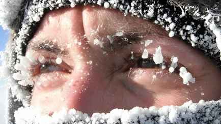 Смерть в течение часа – Судмедэксперты рассказали, как не замёрзнуть в морозы и почему алкоголь не согревает