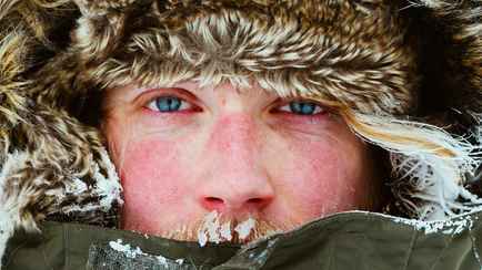 Эти 6 симптомов зимой указывают на неприятное заболевание. Как отличить аллергию на холод от обморожения?
