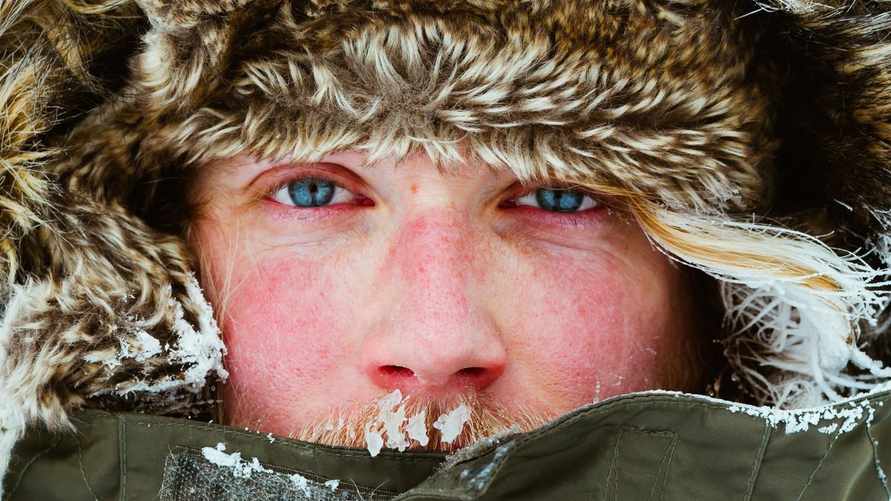 Эти 6 симптомов зимой указывают на неприятное заболевание. Как отличить аллергию на холод от обморожения?