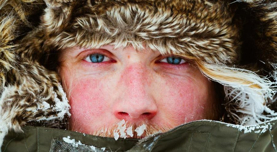 Что такое аллергия на холод Аллергия на холод,