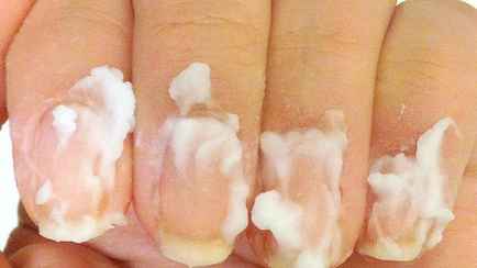 Зачем белорусам втирать соду в ногти? Этот полезный массаж займет всего несколько минут