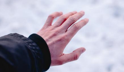 Что делать, если зимой руки становятся грубыми и сухими? 12 советов и 7 несложных домашних рецептов по уходу