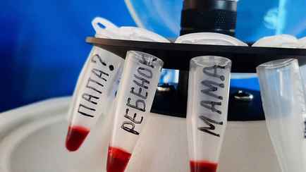 Из пяти ни одного. Судмедэксперты на примере показали, кому из белорусов стоит пройти ДНК-тест на отцовство