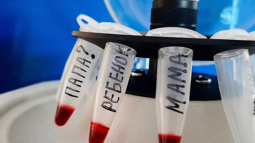 Из пяти ни одного. Судмедэксперты на примере показали, кому из белорусов стоит пройти ДНК-тест на отцовство