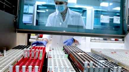 Панацея? Испанские ученые заявили, что создали антитело от всех штаммов Covid-19