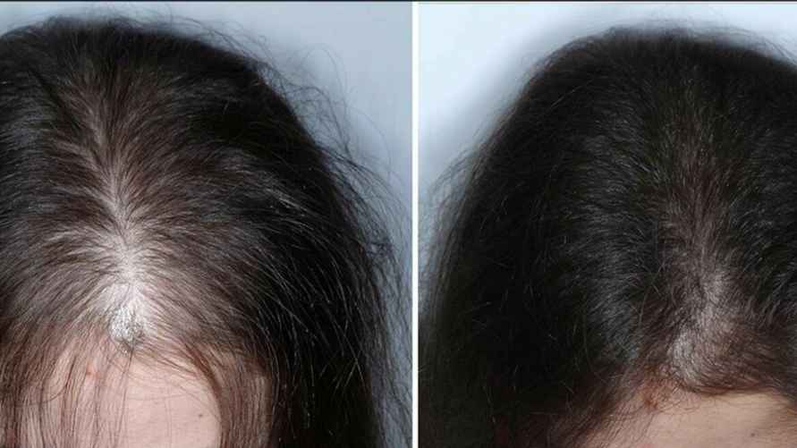 Фото иллюстрационное