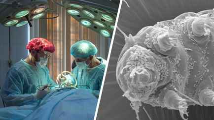 Учёные открыли протеин, замедляющий старение. Его взяли у тихоходок и внедрили в клетки людей