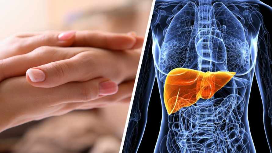 Этот признак на коже может указывать на проблемы с печенью. Когда идти к врачу?