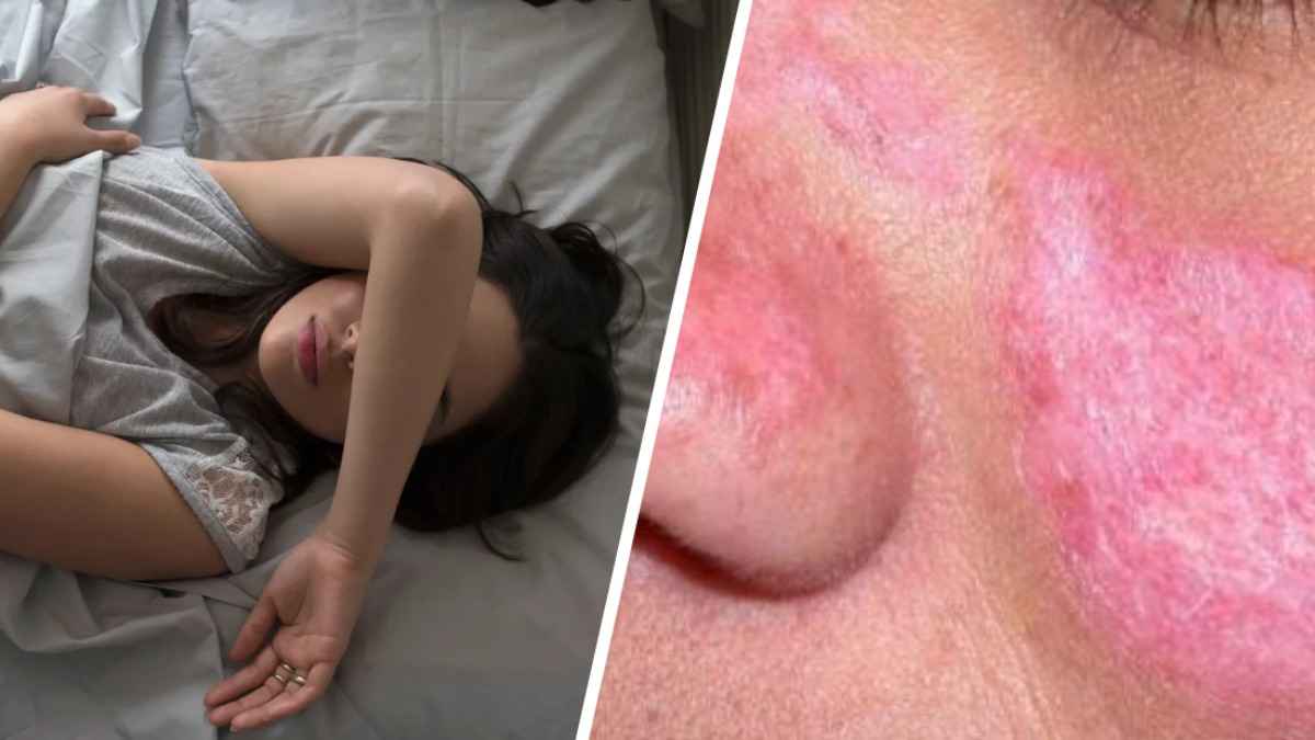 Такие сны могут сигнализировать о начале аутоиммунного заболевания. На что ещё нужно обратить внимание?