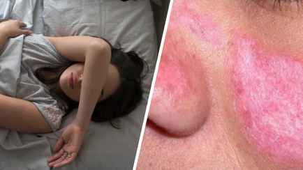 Такие сны могут сигнализировать о начале аутоиммунного заболевания. На что ещё нужно обратить внимание?