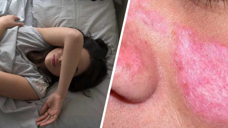 Такие сны могут сигнализировать о начале аутоиммунного заболевания. На что ещё нужно обратить внимание?