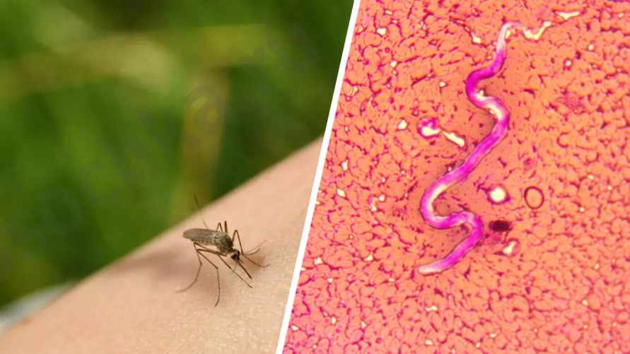 "Опухоль, которая перемещается" - Врач предупредила белорусов об опасности укусов комаров