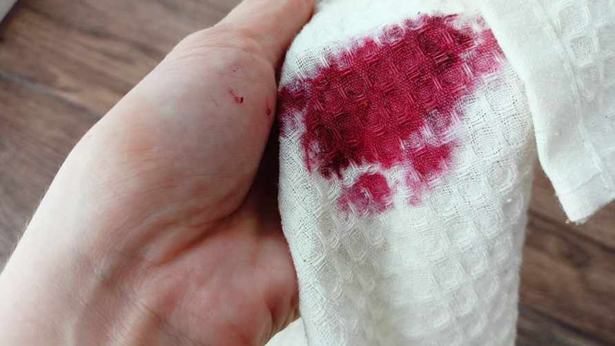 Фото: Telegraf.news