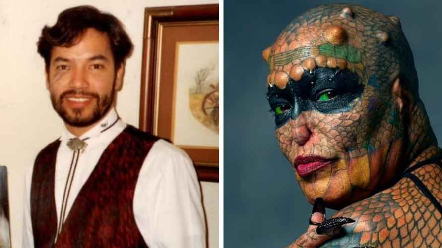 "Человек дракон" до и после пластики