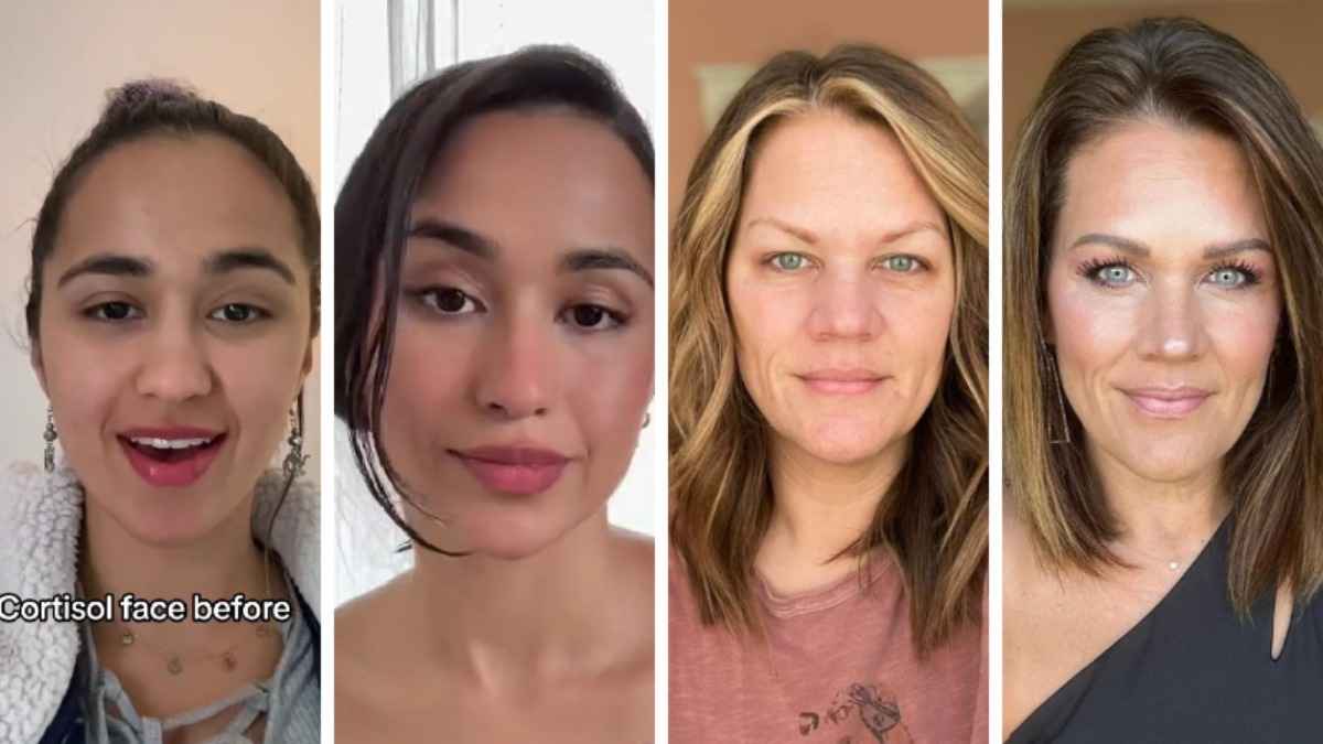 В TikTok завирусился тренд на самодиагностику "кортизолового лица". Как измерить белорусам?