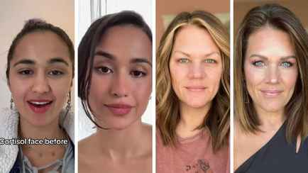 В TikTok завирусился тренд на самодиагностику «кортизолового лица». Как измерить белорусам?