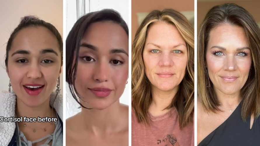 В TikTok завирусился тренд на самодиагностику "кортизолового лица". Как измерить белорусам?