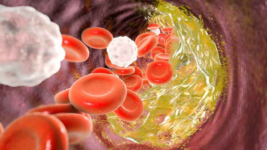 Фото: getty images