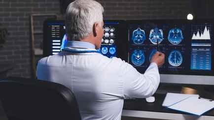 Как белорусам отметить Всемирный день мозга? Пройдите быстрый тест и узнайте, на что способен ваш