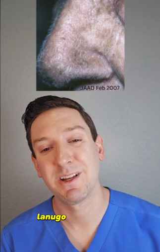 Волосы на носу — признак рака? Дерматолог рассказал миллиону подписчиков, какую примету на коже нельзя игнорировать