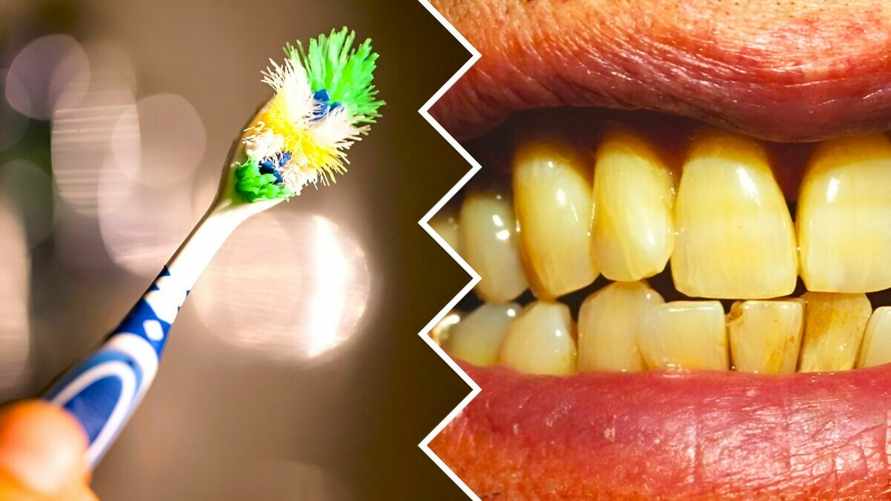 Когда лучше чистить зубы — до или после завтрака? Стоматолог объяснил, в каком случае они станут жёлтыми, как у курильщика