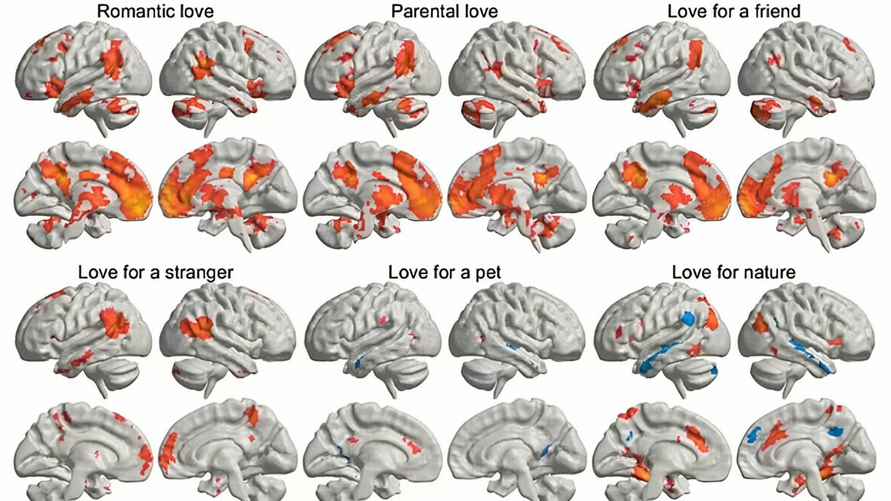 Карта мозговой активности при различных видах любви: 1. Любовь к партнёру; 2. Родительская любовь; 3. К другу; 4. К незнакомцу; 5. К домашнему питомцу; 6. К природе. Фото: Daily Mail.