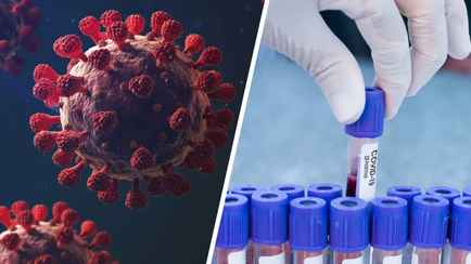 В Минздраве ответили, есть ли в Беларуси новый штамм коронавируса XEС. Какие симптомы при заражении?