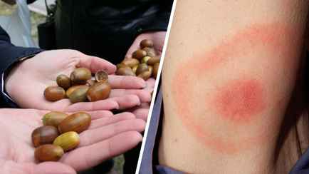 В Польше забили тревогу из-за сверхурожая желудей. Чем грозит людям через 2 года?