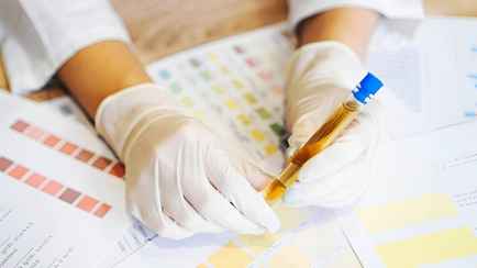 Учёные из Кембриджа заявили, что создали первый в мире тест мочи, который способен выявить рак