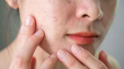 Эти 5 изменений кожи должны вас насторожить. Врач объяснила, когда нужно срочно обследоваться