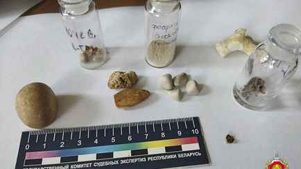 «Камни преткновения» — Судмедэксперты рассказали, какую услугу они оказывают болеющим белорусам